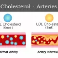 Wat wordt bedoeld met totaal cholesterol?