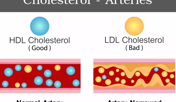 Wat wordt bedoeld met totaal cholesterol?