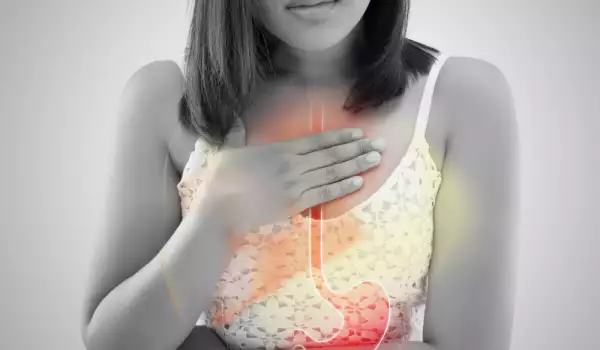 Reflux bij gastritis